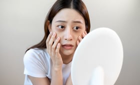 不用醫美!輕鬆消除黑眼圈的天然秘方大公開
